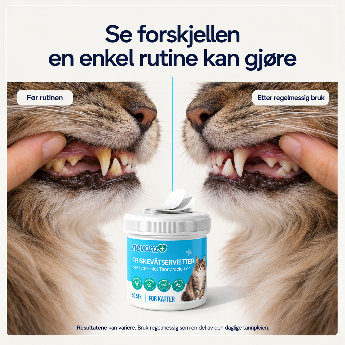 FreshWipes Plakkfjerningssett